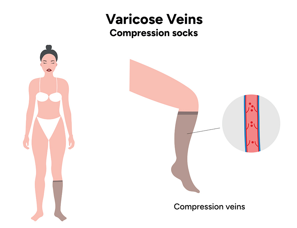 Compression Socks Benefits | What Do Compression Socks Do | Purpose of Compression Socks