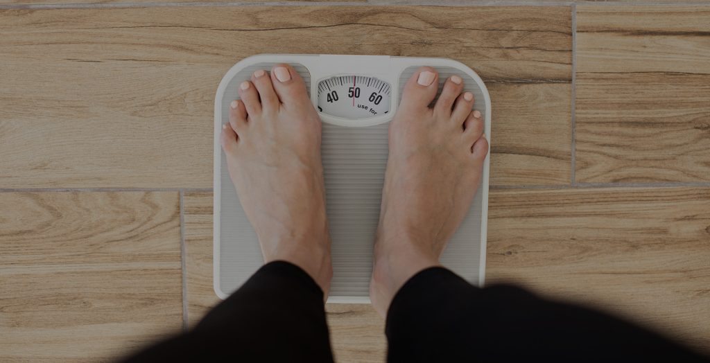 Prevent Varicose Veins | Weight Loss and Varicose Veins | Obesity Varicose Veins